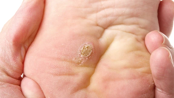 Mõni sõlm võib olla päris valulik.