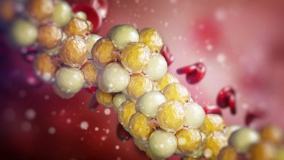 Kaalu ja kolesterooli vaheline suhe pole kindel. Ka saledal inimesel võib probleem olla.